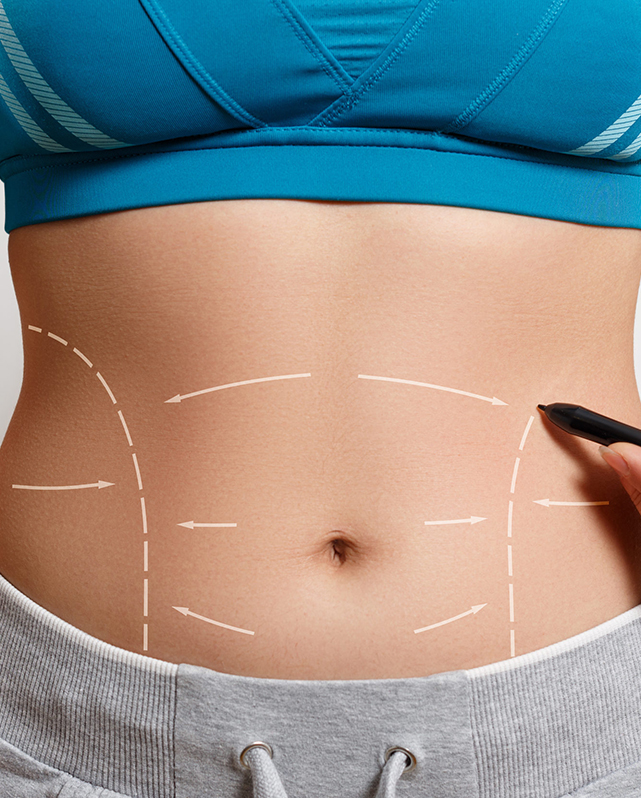 Dr. David Abdominoplastia