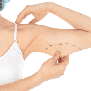 Braquioplastia para Braços Firmes